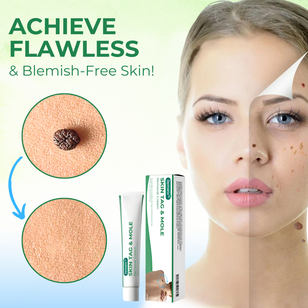 Dermanix™ Skin Tag & Mole Removal Cream