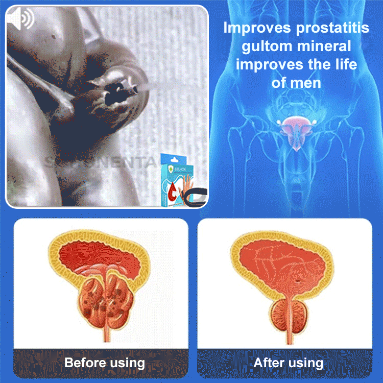 Prostate Care Point Clip【Guaranteed 100% authentic, great value deal! 】
