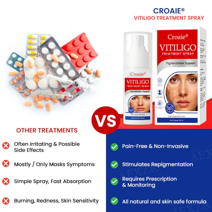 FDA Approved WHO Approved Croaie® Vitiligo Treatment Sparay-No allergies Quick and effective With over 150000 sold!