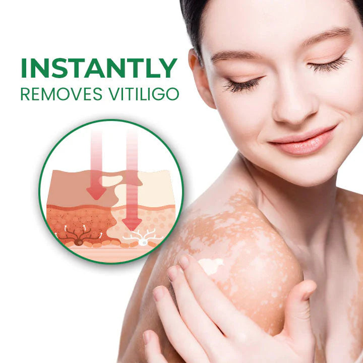 Fivfivgo™ White Spot Repair Cream