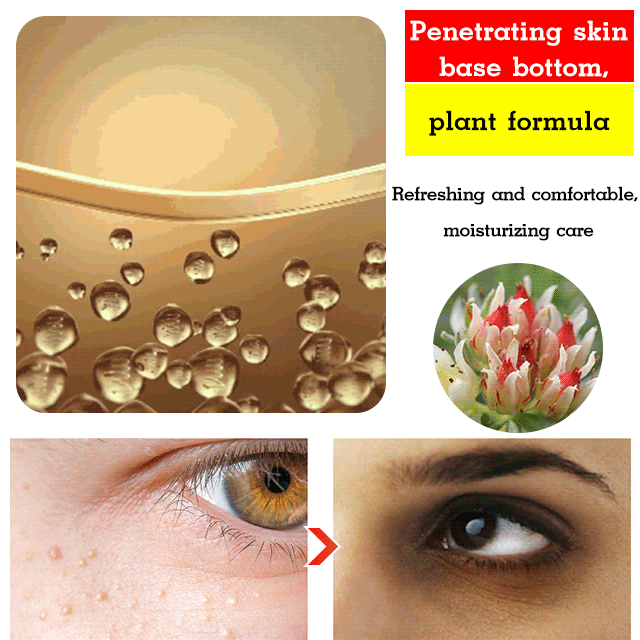 South Moon Fat Granule Remover Serum