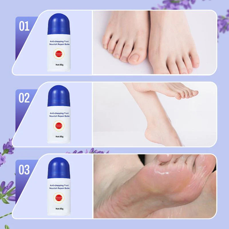 🔥Sold over 100 000❤️Nourishing and repairing foot cream for cracks🎁50% off limited time benefits