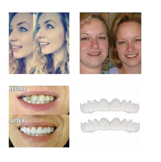 Magic Smile Teeth Brace 【Can eatting】100% non-inductive fit, no foreign body sensation!😁 (💥45% OFF) - 🔥HOT SALE🔥🎉