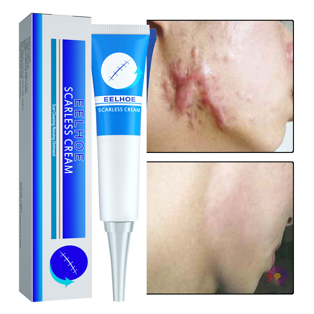 BEST SCAR REMOVER CREAM™【buy one get one free】