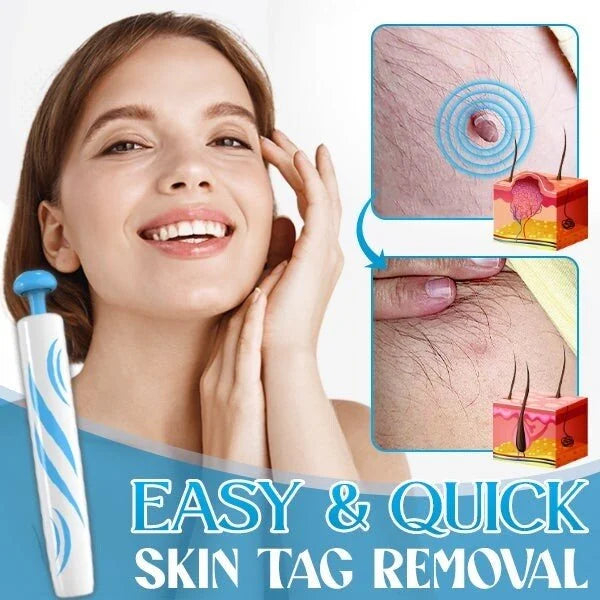 Auto-Micro Skin Tag Remover