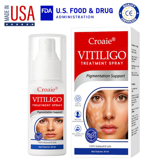 FDA Approved WHO Approved Croaie® Vitiligo Treatment Sparay-No allergies Quick and effective With over 150000 sold!