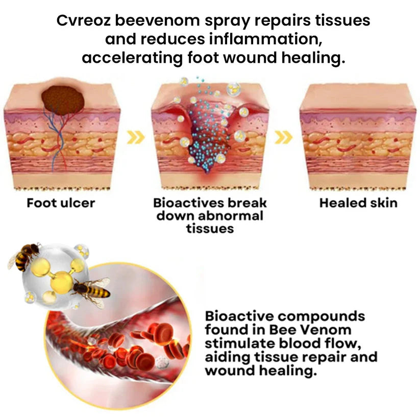 ⏰Last Day Promotion: 60% OFF 🔥CVREOZ® Bee Venom Diabetic Foot Treatment Spray