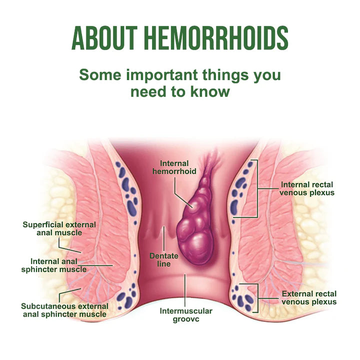 Hemorrhoidal Ointment