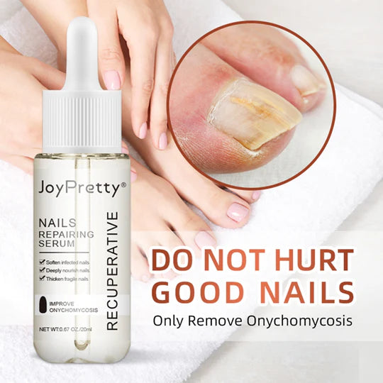 JoyPretty™️ Nagelsvamp Serum