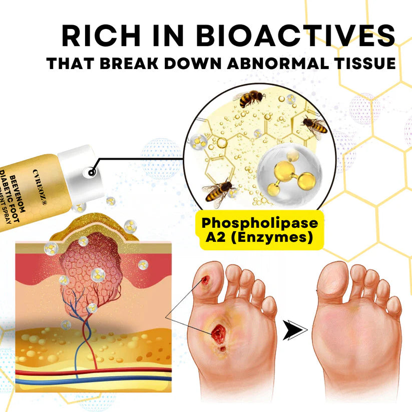 ⏰Last Day Promotion: 60% OFF 🔥CVREOZ® Bee Venom Diabetic Foot Treatment Spray