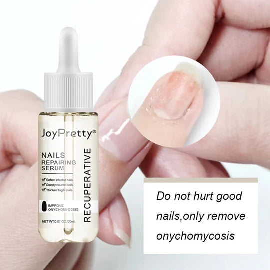 JoyPretty™️ Nagelsvamp Serum