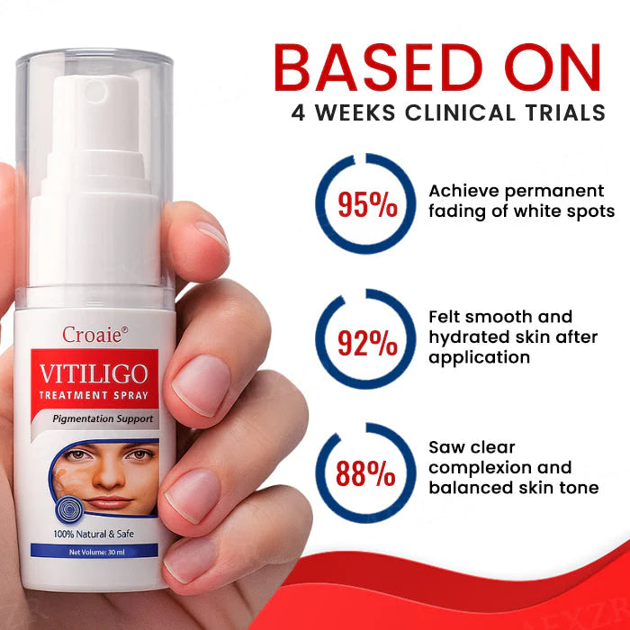 FDA Approved WHO Approved Croaie® Vitiligo Treatment Sparay-No allergies Quick and effective With over 150000 sold!