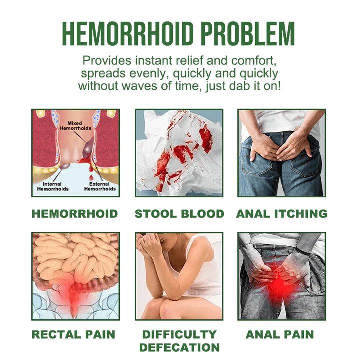 Hemorrhoidal Ointment