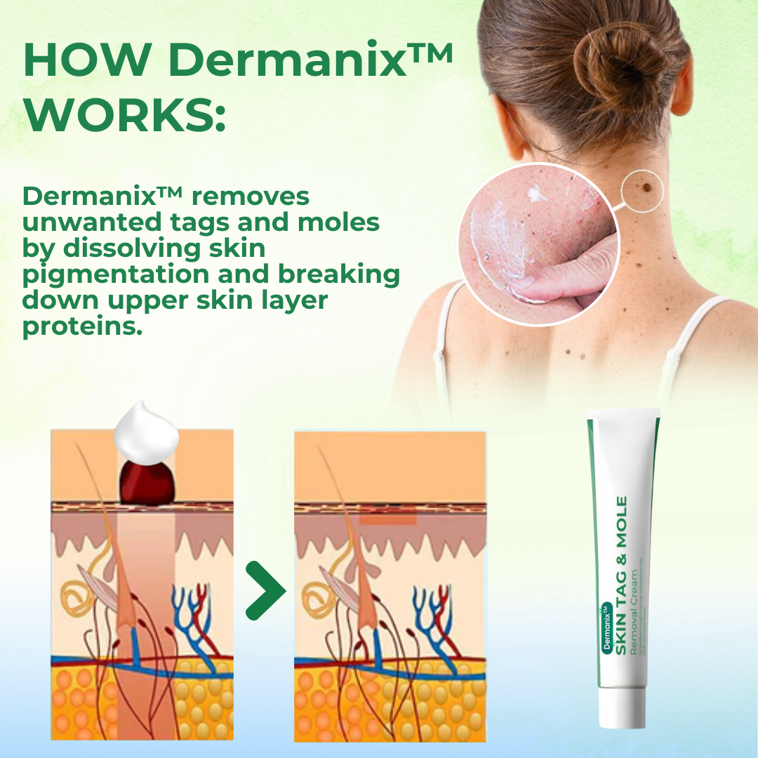 Dermanix™ Skin Tag & Mole Removal Cream