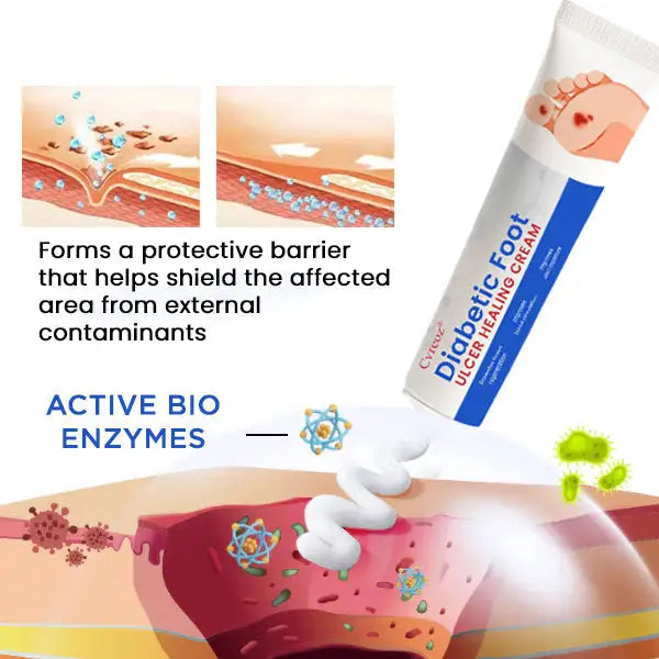 Cvreoz® Diabetic Foot Ulcer Healing Cream