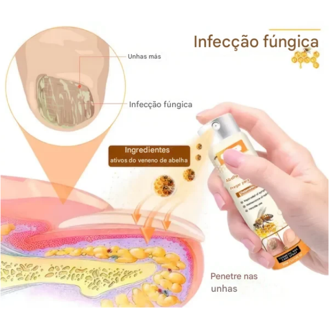 Limited-time sale until 2025🎁 with 70% off⏳ on Ceoerty® nail fungus spray with bee venom 💥 solves all nail problems in 2 weeks