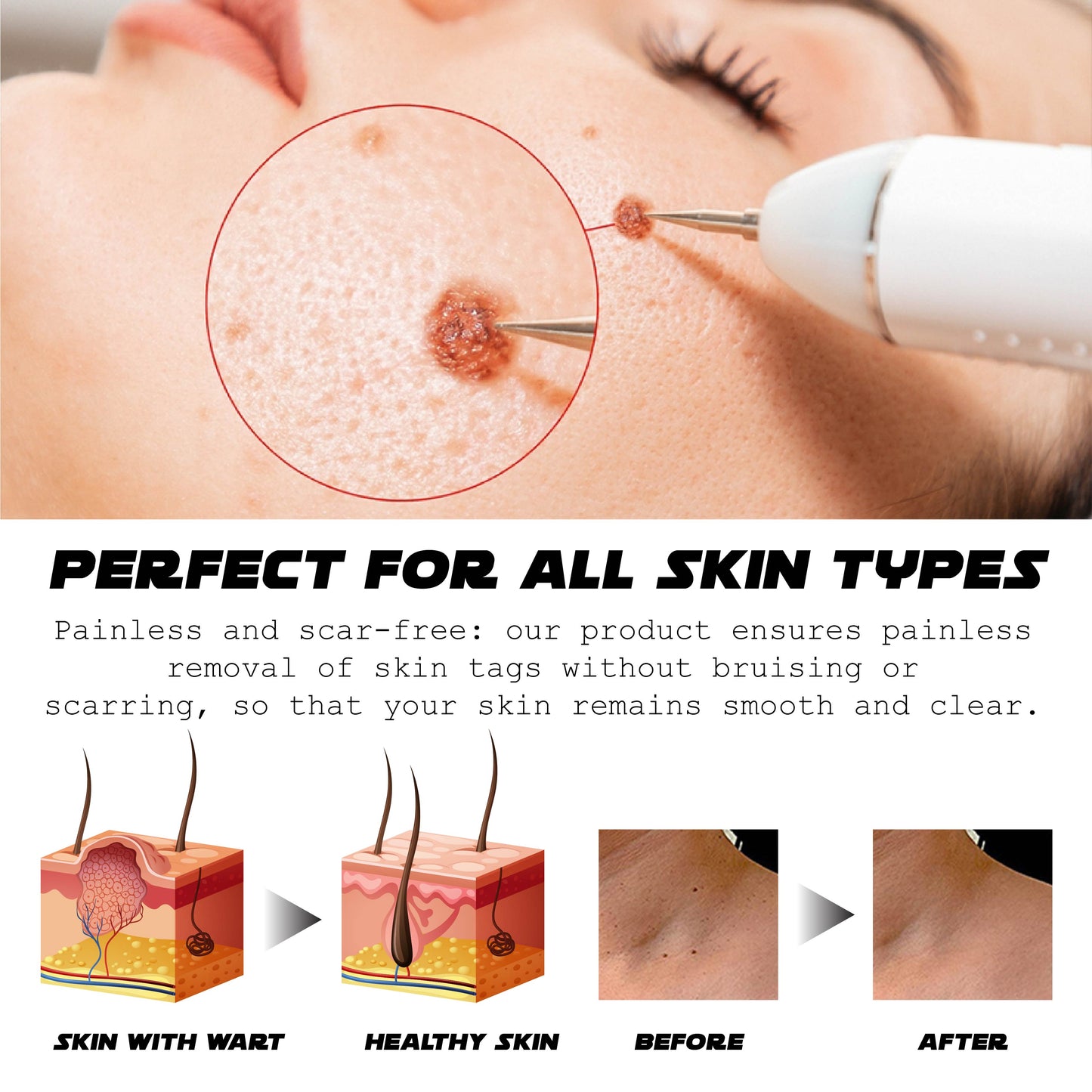 RICPIND SpotRemoval Pro Beauty Electric Pen