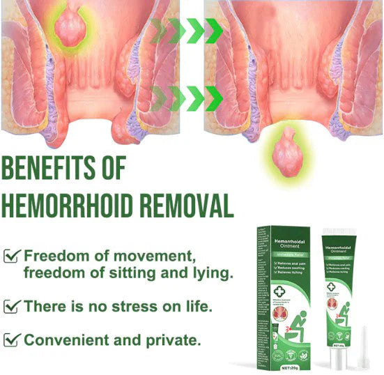 Hemorrhoidal Ointment