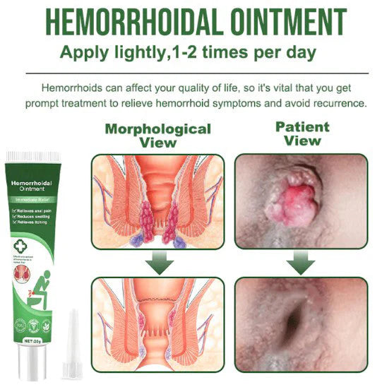 Hemorrhoidal Ointment