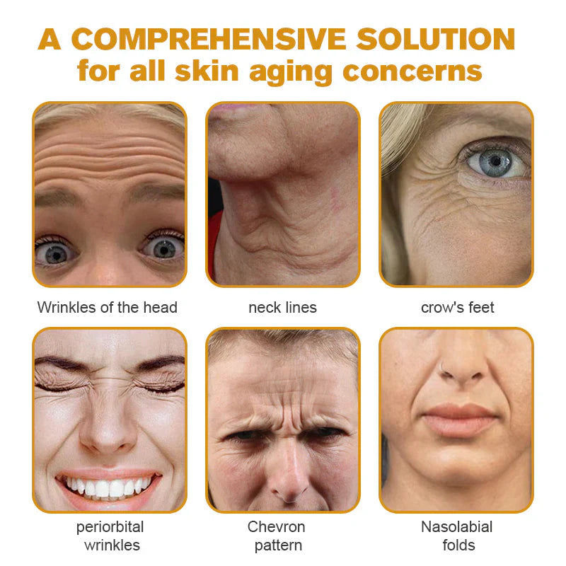 👨‍⚕️ LAST DAY 49% OFF✅ Botox Bee Venom Wrinkle Removal Cream