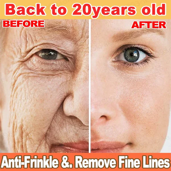 Tiworld™ Rapid Anti Wrinkle Serum, Face Lift Cream, Instant Wrinkle Remover for Face, Eye Bag and Neck, Wrinkle Cream for Face Deep Wrinkles