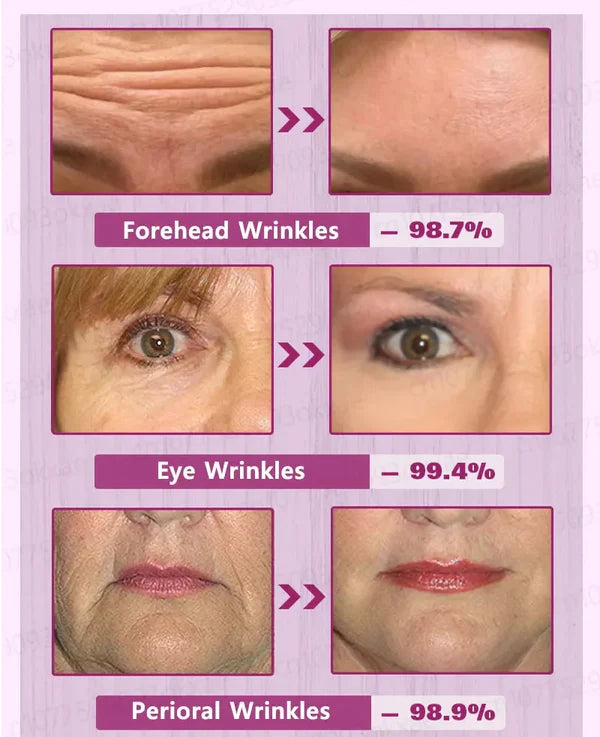 Tiworld™ Rapid Anti Wrinkle Serum, Face Lift Cream, Instant Wrinkle Remover for Face, Eye Bag and Neck, Wrinkle Cream for Face Deep Wrinkles