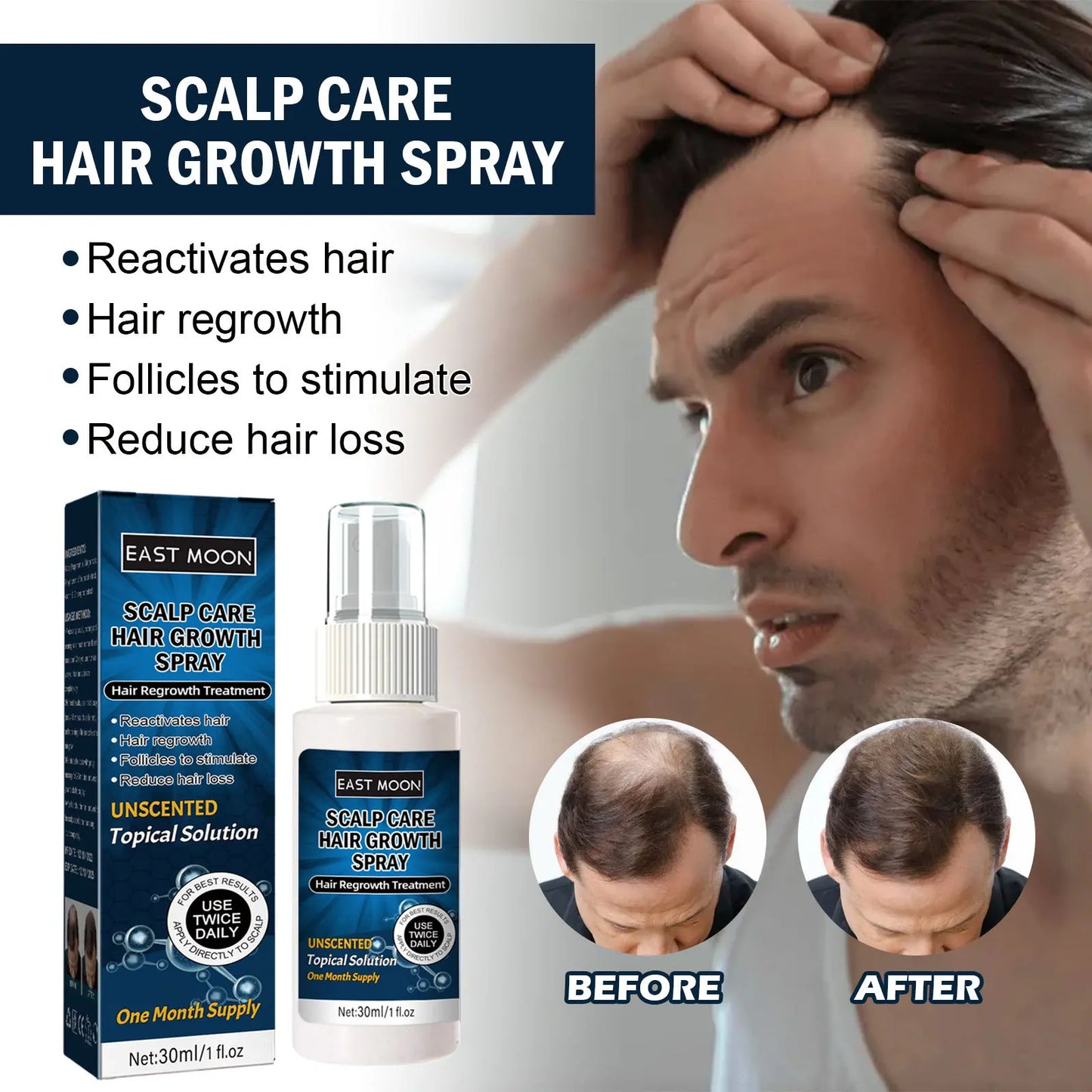 Minoxidil Strands Hair Growth Spray