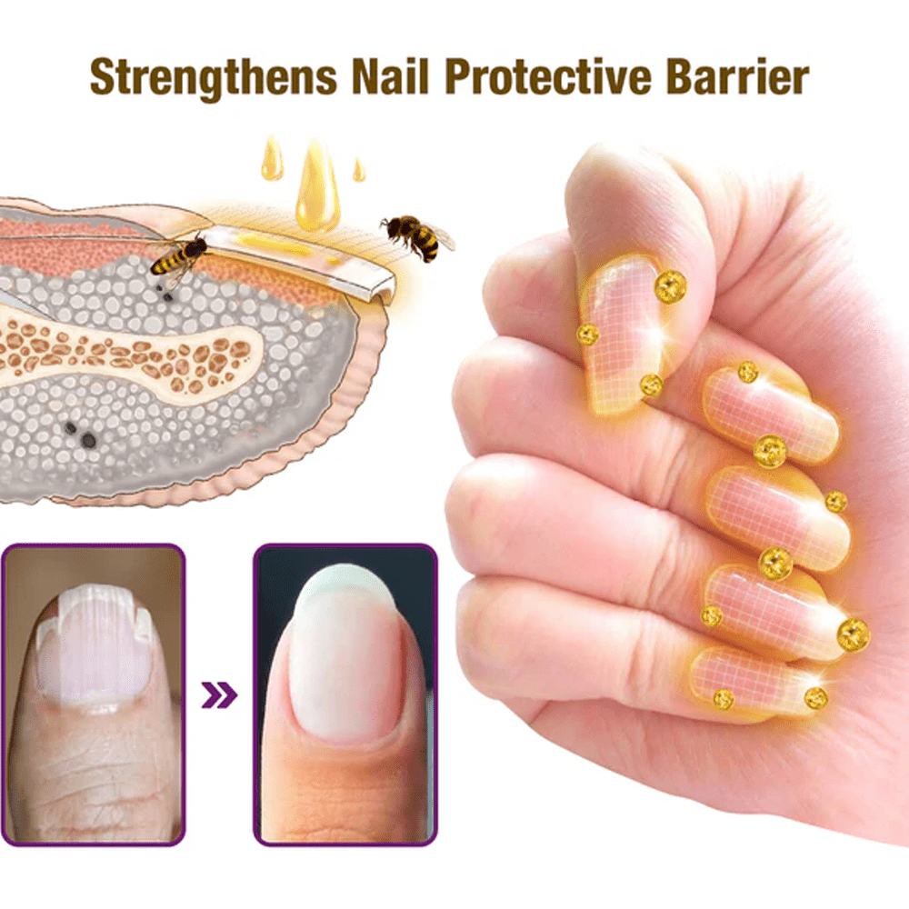 flysmus™ FungiFree Bee Venom Nail Treatment Serum