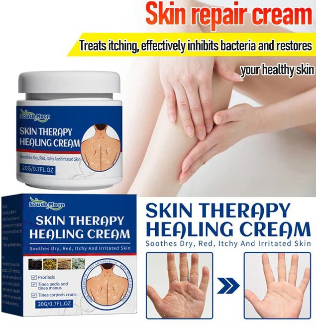 I try it and it really works ！Eczema Redness Itching Relief Skin Repair Cream