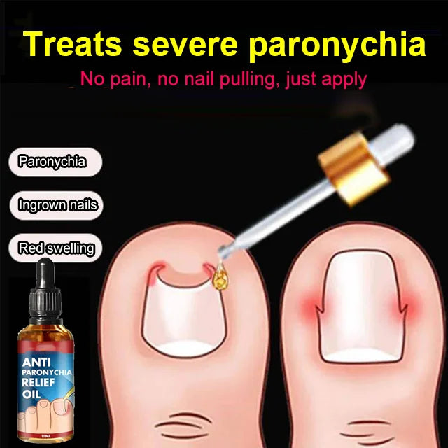 Completely cured in 10 daysspecial ！Jaysuing Anti Paronychia Relief Oil