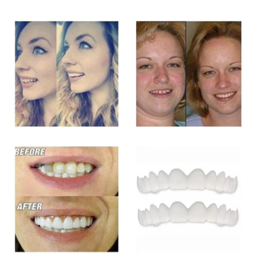 Magic Smile Teeth Brace 【Can eatting】100% non-inductive fit, no foreign body sensation！😁 (💥45% OFF) - 🔥HOT SALE🔥🎉