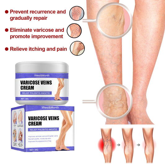 Varicose Vein Care Cream