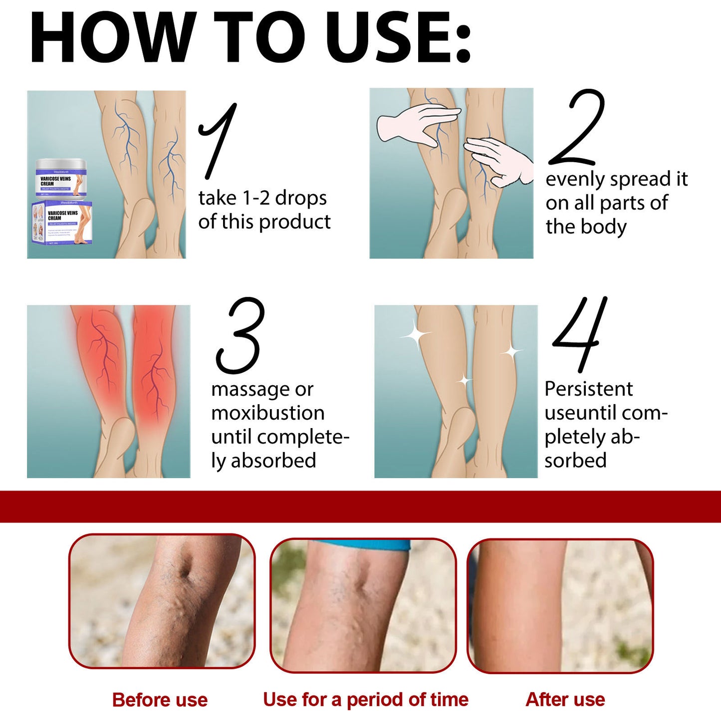 Varicose Vein Care Cream